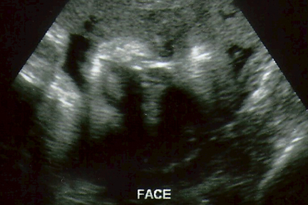 baby face sonogram